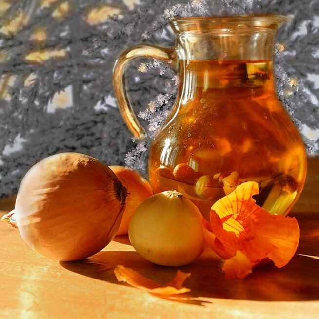 Hagyma infúzió, hogy megszabaduljon a parazitáktól